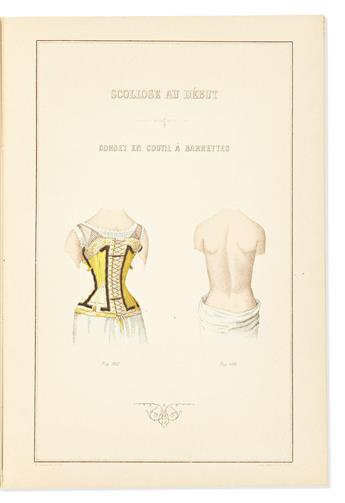 Rainal Frères, Léon & Jules. Orthopédie: Déviation du Rachis; Mal de Pott; Luxations Congénitale; Coxalgie.